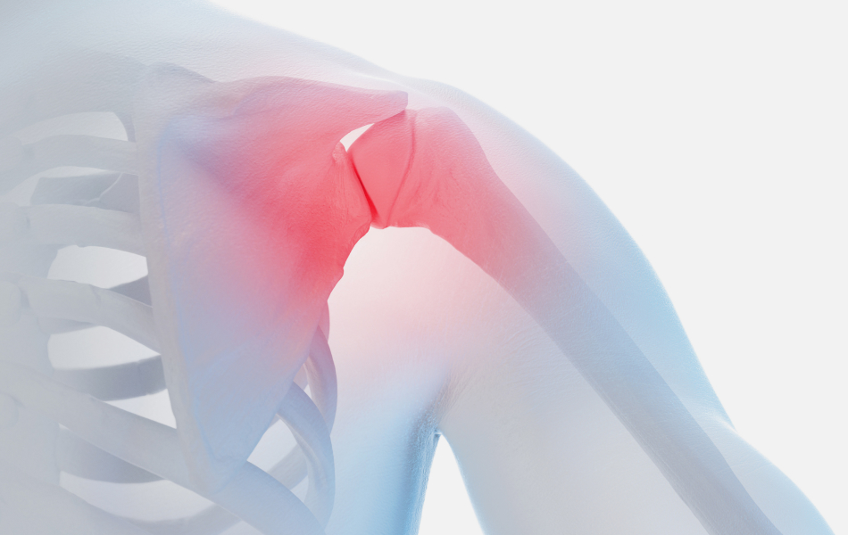 어깨·팔꿈치 클리닉